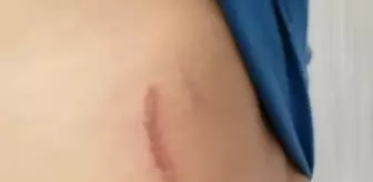 Manisa'daki 'yol verme' kavgasına 8 tutuklama