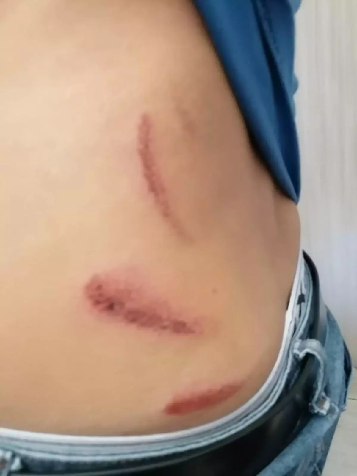 Manisa'daki 'yol verme' kavgasına 8 tutuklama