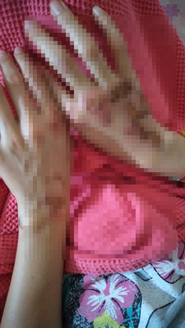 Bir scooter faciası daha! Hızla gelen araç, yolda ilerleyen genç hemşireyi biçti geçti