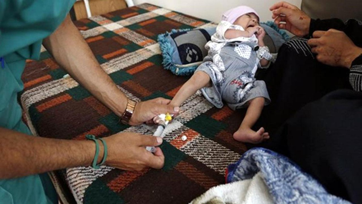 Artan Gıda Fiyatları Yüzünden Yetersiz Beslenen Yemenli Çocuklar Açlıkla Burun Buruna