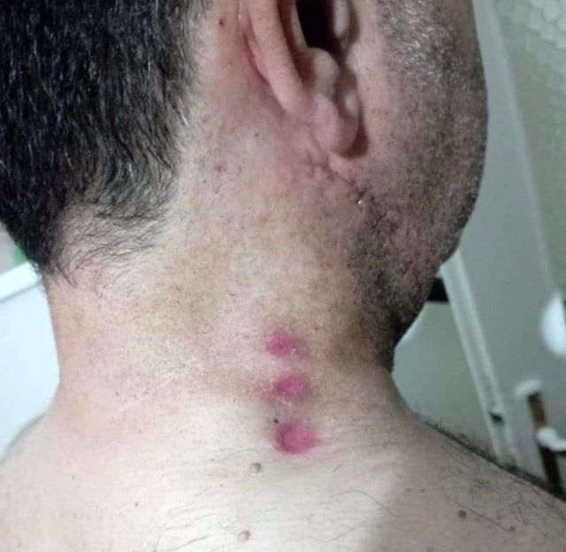 İndi bindi ücretini fazla bulan yolcu, silahını çekip taksiciyi boynundan vurdu İndi bindi ücretini fazla bulan yolcu, silahını çekip taksiciyi boynundan vurdu