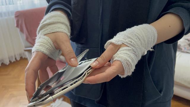 Yolda yürürken tacize uğrayıp öldüresiye darbedilen genç kız yaşadığı dehşeti anlattı: Ezmeye çalıştı, peşinden gelip tekme tokat dövdü