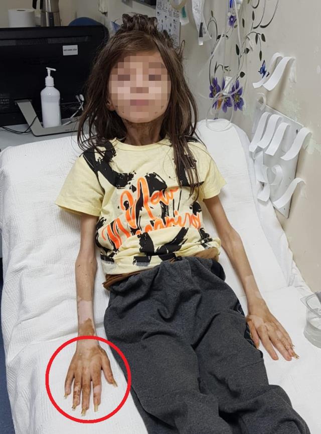 Muhammet'i çöp evde esir tutan teyze: Kendisine yaklaştırmadığı için tırnakları ve saçları uzadı Muhammet'i çöp evde esir tutan teyze: Kendisine yaklaştırmadığı için tırnakları ve saçları uzadı