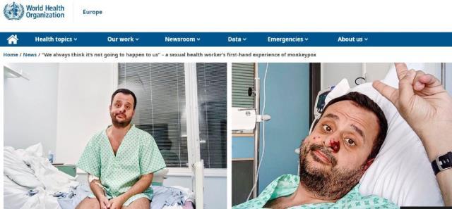 Maymun çiçeğine yakalanan Türk vatandaşı konuştu: Öleceğimi sandım