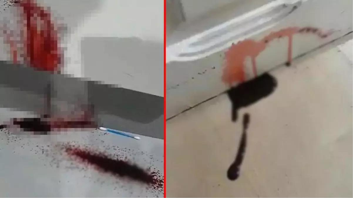 Yeni evlerinin duvarından kan sızıyor! Gözlerine uyku girmiyor