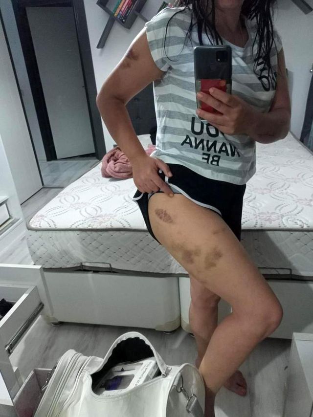Öz annesi tarafından parayla satıldı, eşinden şiddet gördü! Saime'den yardım çığlığı Öz annesi tarafından parayla satıldı, eşinden şiddet gördü! Saime'den yardım çığlığı