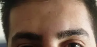 Hemşirenin burnunu kıran hasta yakını bu kez tutuklandı