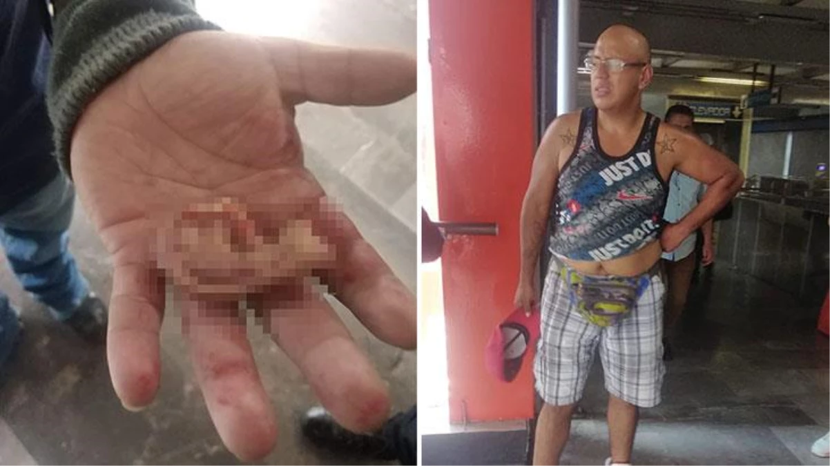 Kadının taciz iddiasının ardından ortalığın karıştığı metroda bir kişinin kulağı koptu