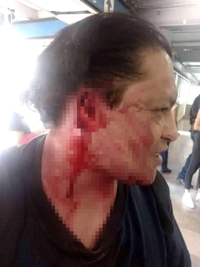 Kadının taciz iddiası metroyu karıştırdı! Kavga edenlerden birinin kulağı koptu