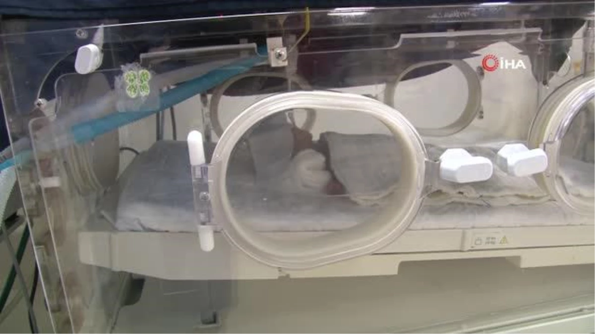 Şırnak\'tan getirilen 25 haftalık 775 gramlık bebeğin tedavisi sürüyor