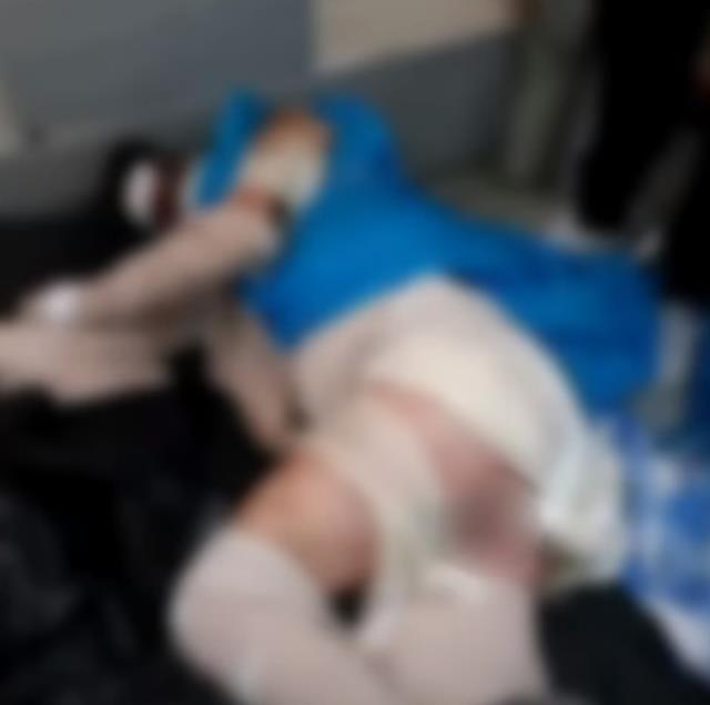 Eski sevgilisinin üzerine benzin döküp yaktığı karnaval kraliçesi hayatını kaybetti Eski sevgilisinin üzerine benzin döküp yaktığı karnaval kraliçesi hayatını kaybetti
