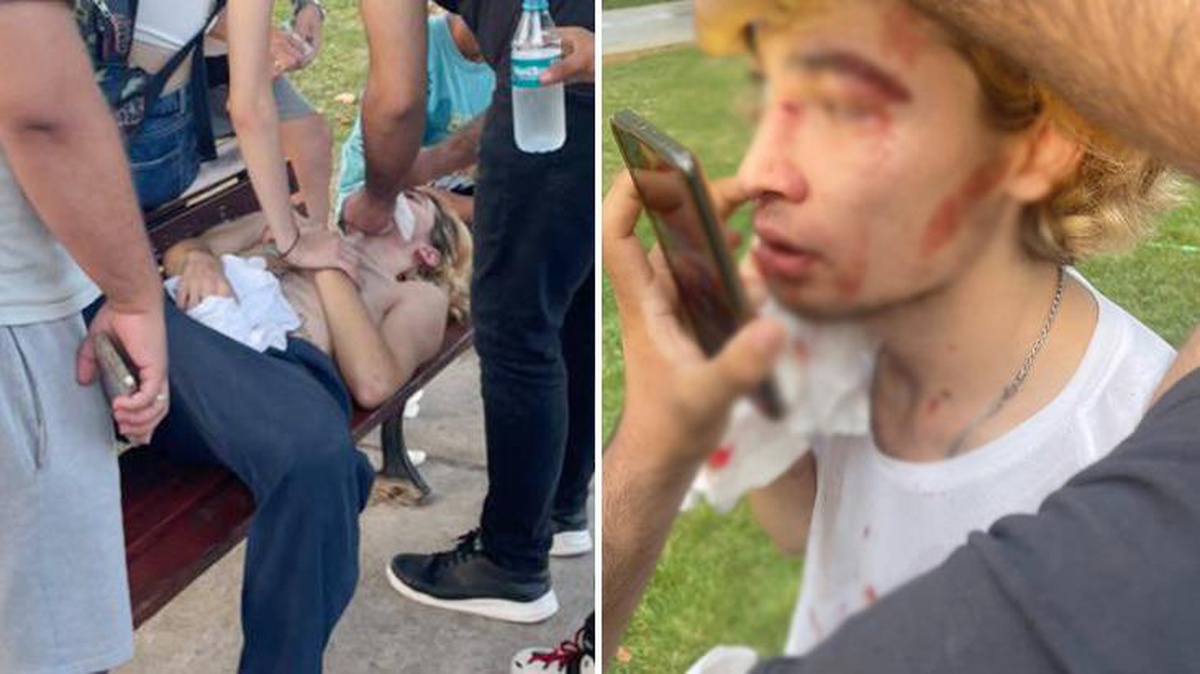 Türkiye şampiyonu milli sporcu sokakta antrenman yaparken tekme tokat dövüldü! Burnu kırıldı, kaşı açıldı, yüzünde morluklar oluştu