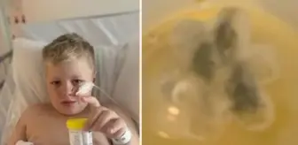 Bu nasıl doktorluk! 5 yıl önce astım teşhisi konulan çocuğun boğazından plastik oyuncak çıktı