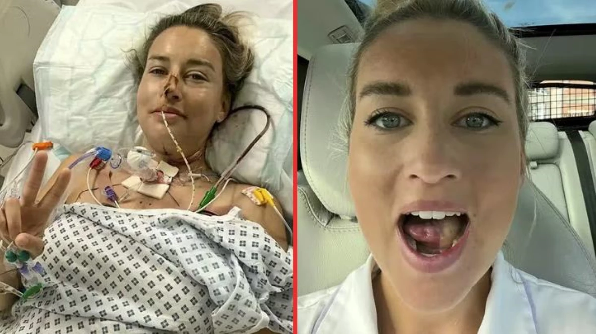 İngiltere'de ağız kanseri olan genç kızın dilini kasık etiyle tedavi ettiler