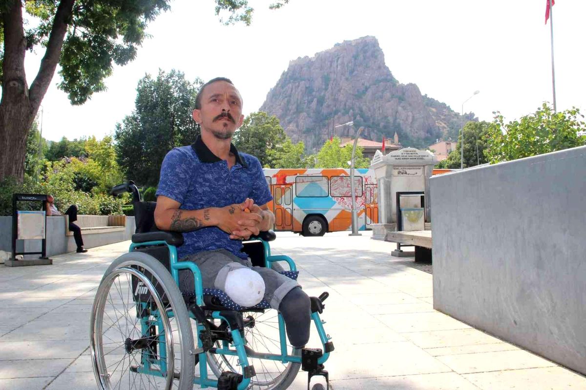 Bir yılda iki bacağını da kaybetti
