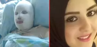 5 buçuk aylık hamileliğini sonlandırmak istemedi! Kocasının gaz tüplü saldırısına uğradı
