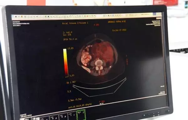 Karnından, 10 kiloluk kanserli kitle çıkarıldı