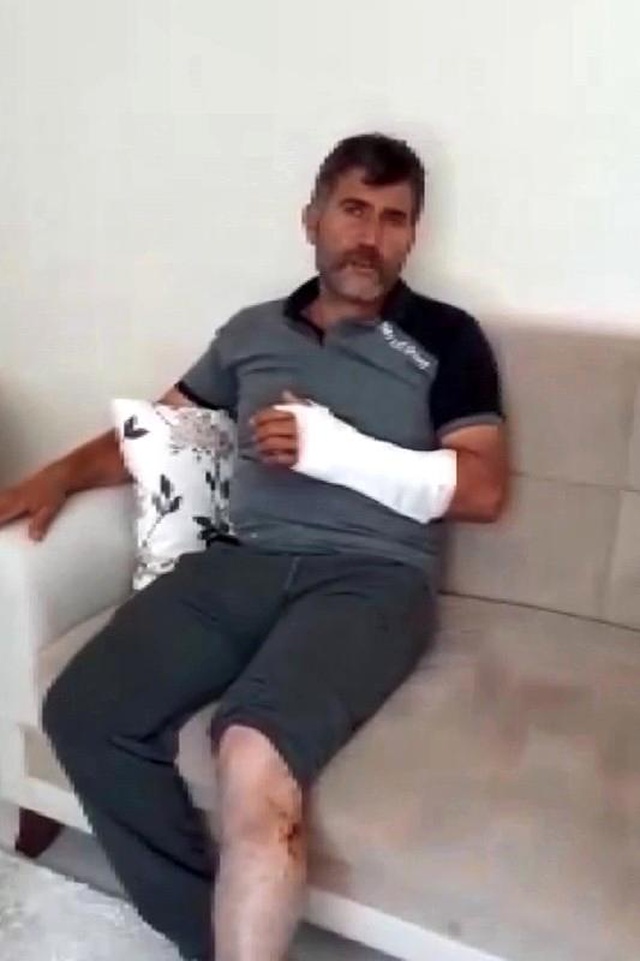 Öldü sandığı ayı saldırdı, güreşerek hayatta kaldı Öldü sandığı ayı saldırdı, güreşerek hayatta kaldı
