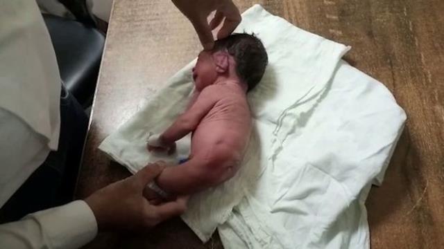 Doğumhanede bebeğin belden aşağısına bakan doktorlar gözlerine inanamadı: Aileyi hastaneden çıkarın