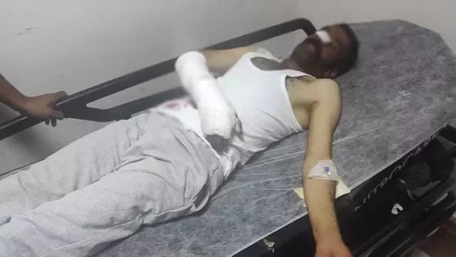 Ayı saldırısına uğrayan ve yaralanan çobanı köpekler kurtardı Ayı saldırısına uğrayan ve yaralanan çobanı köpekler kurtardı