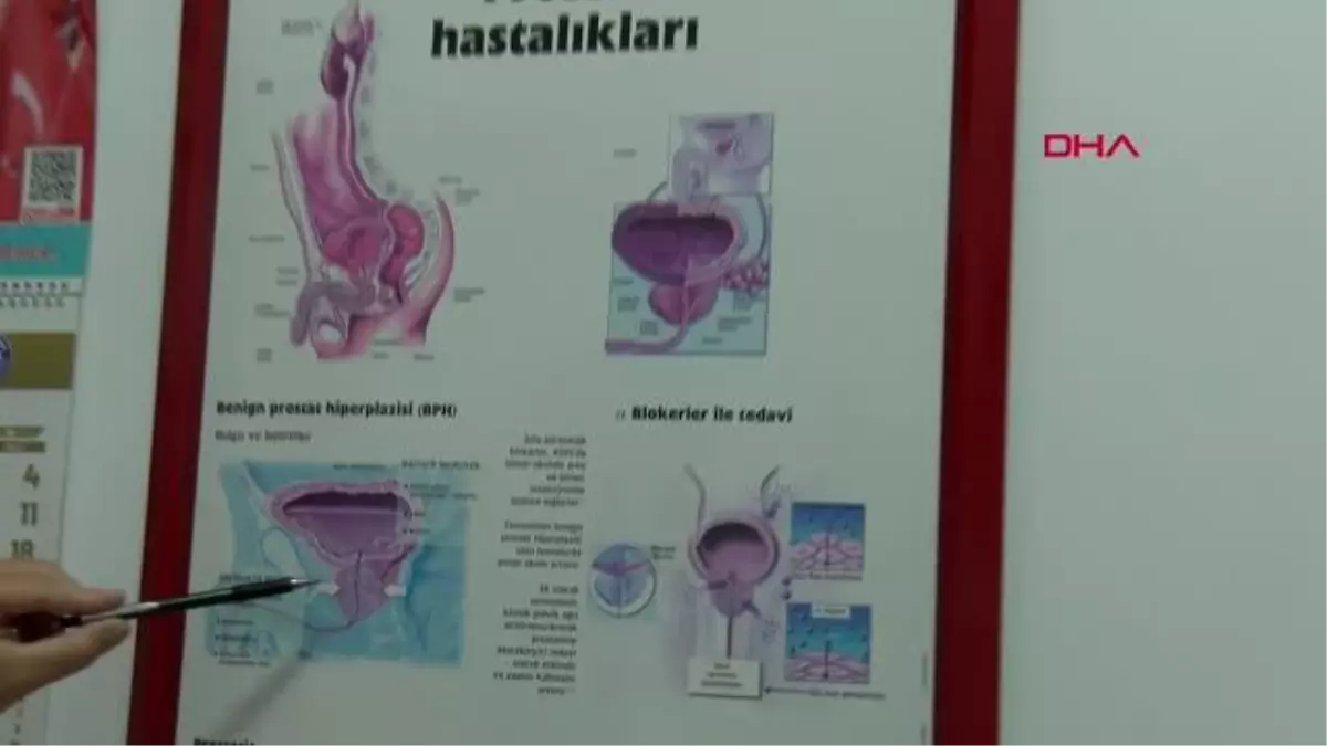 AİLESİNDE PROSTAT KANSERİ OLAN ERKEKLERE UYARI