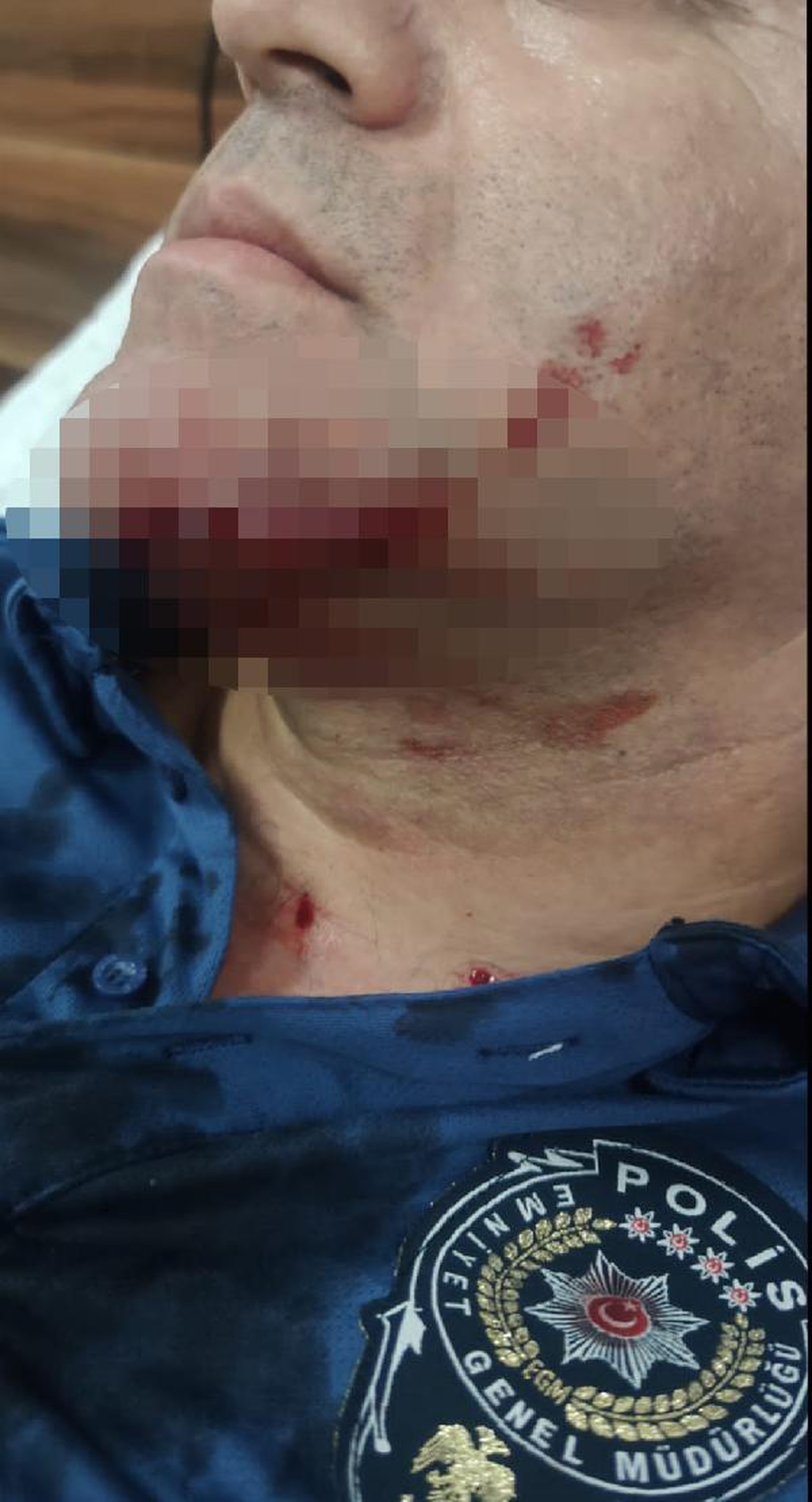 Son dakika haber: Polisi bıçakla yüzünden yaralayan saldırgan serbest