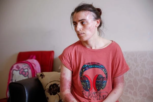Gaziosmanpaşa'da eski elti dehşeti! 17 kez bıçaklayıp üzerine kaynar su döktü