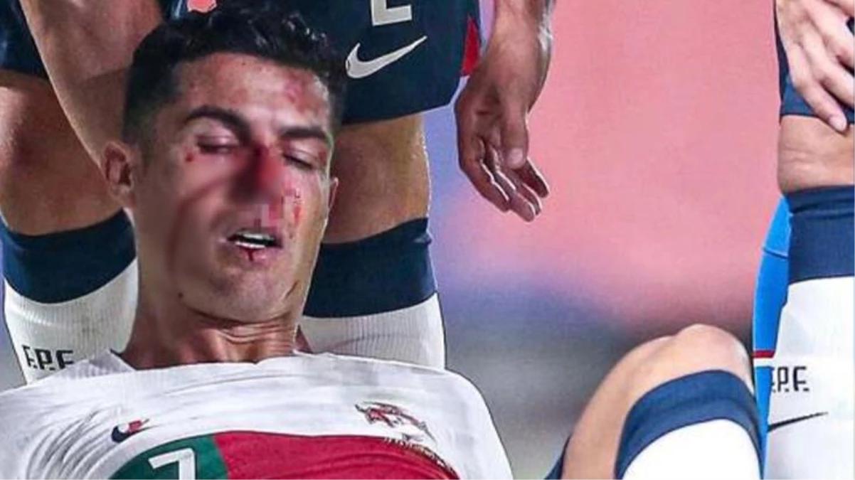 Sahada kanlar içinde kalan Cristiano Ronaldo\'nun son hali görüntülendi