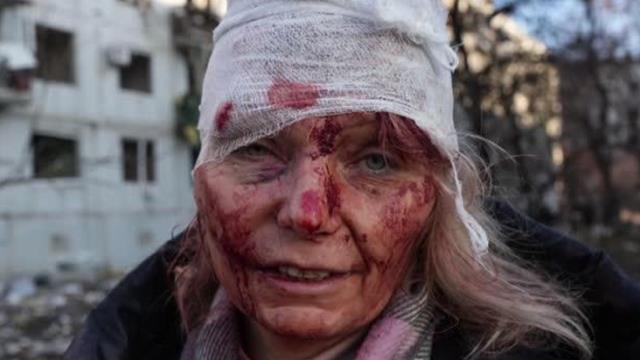 Son dakika haber... AA foto muhabiri Wolfgang Schwan, Rusya-Ukrayna savaşının sembol karesini anlattı