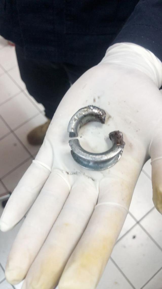 Cinsel organında dayanılmaz ağrıyla hastaneye koştu, vakayı inceleyen doktorlar itfaiyeyi çağırdı Cinsel organında dayanılmaz ağrıyla hastaneye koştu, vakayı inceleyen doktorlar itfaiyeyi çağırdı