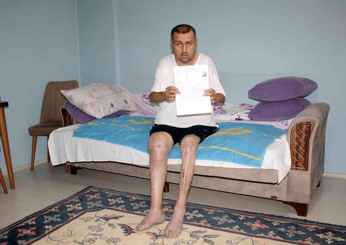 \'Yüzde 98 engelli raporu\' olan vatandaşın bakım parası kesildi