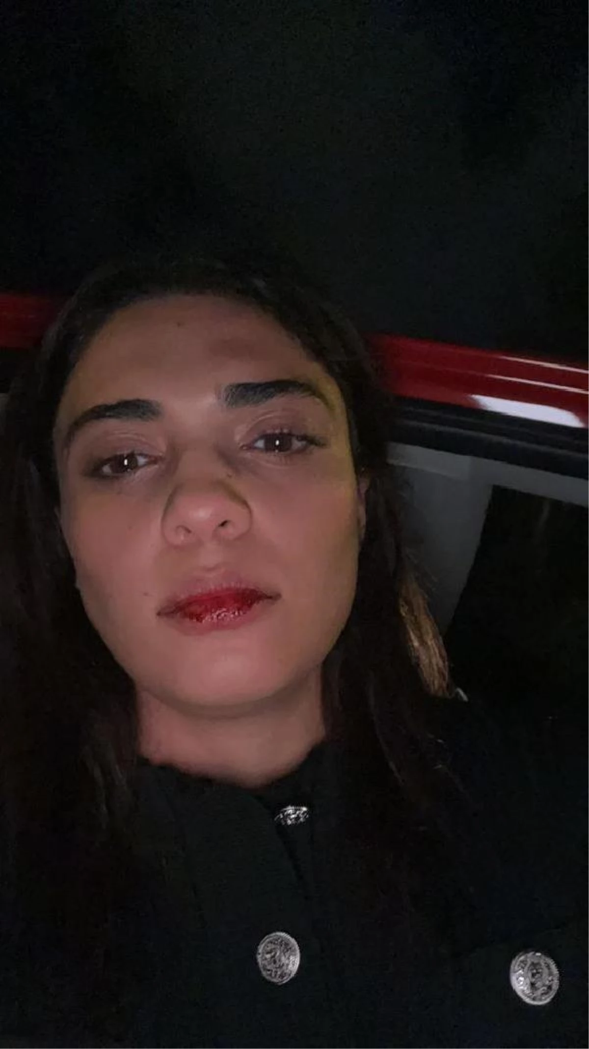 Taksi şoförü aracına çarptığı Azerbaycanlı sanatçıyı darbetti