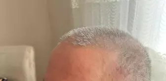 Son dakika haberleri... Adliye ve hastanede dövülen avukata 40 gün iş göremez raporu (2)