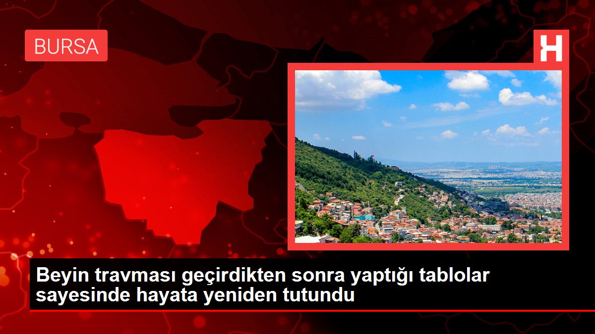 Beyin travması geçirdikten sonra yaptığı tablolar sayesinde hayata yeniden tutundu