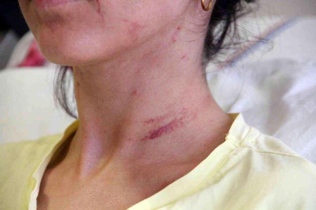 Kıskançlık tartışmasında sevgilisini 5 yerinden bıçaklayan doktorun 20 yıl hapsi istendi