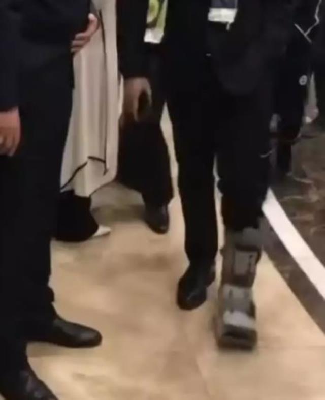 Fenerbahçe Başkanı Ali Koç top oynarken çok sert darbe aldı, ayağında kırık var