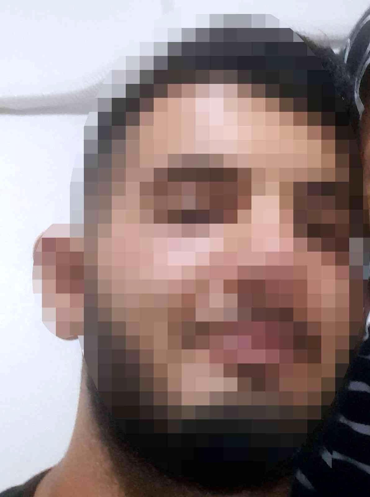 Üvey annesine kezzap döken genç tutuklandı