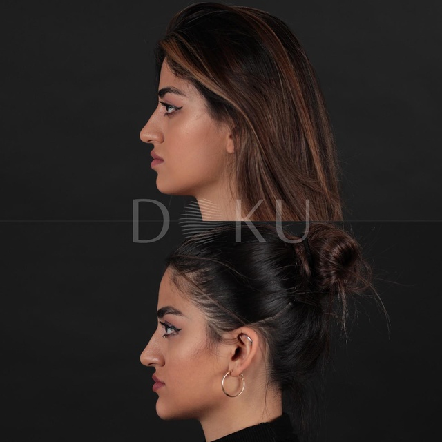 Doku Medical - Bölgesel Zayıflama Doku Medical - Bölgesel Zayıflama