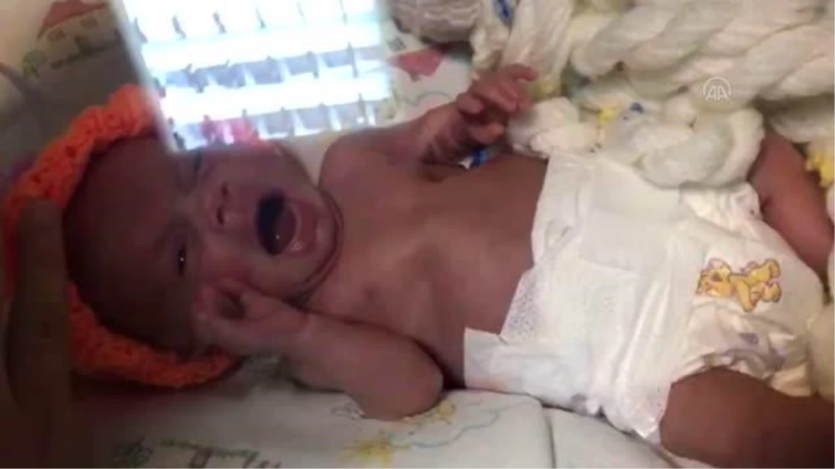410 gram doğan Asya bebek inadına "yaşam" dedi