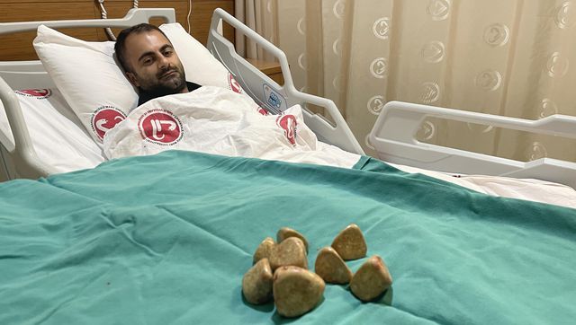 Karın ağrısı şikayetiyle hastaneye giden vatandaş acilen ameliyata alındı: Karşımızda ilginç bir vaka var Karın ağrısı şikayetiyle hastaneye giden vatandaş acilen ameliyata alındı: Karşımızda ilginç bir vaka var