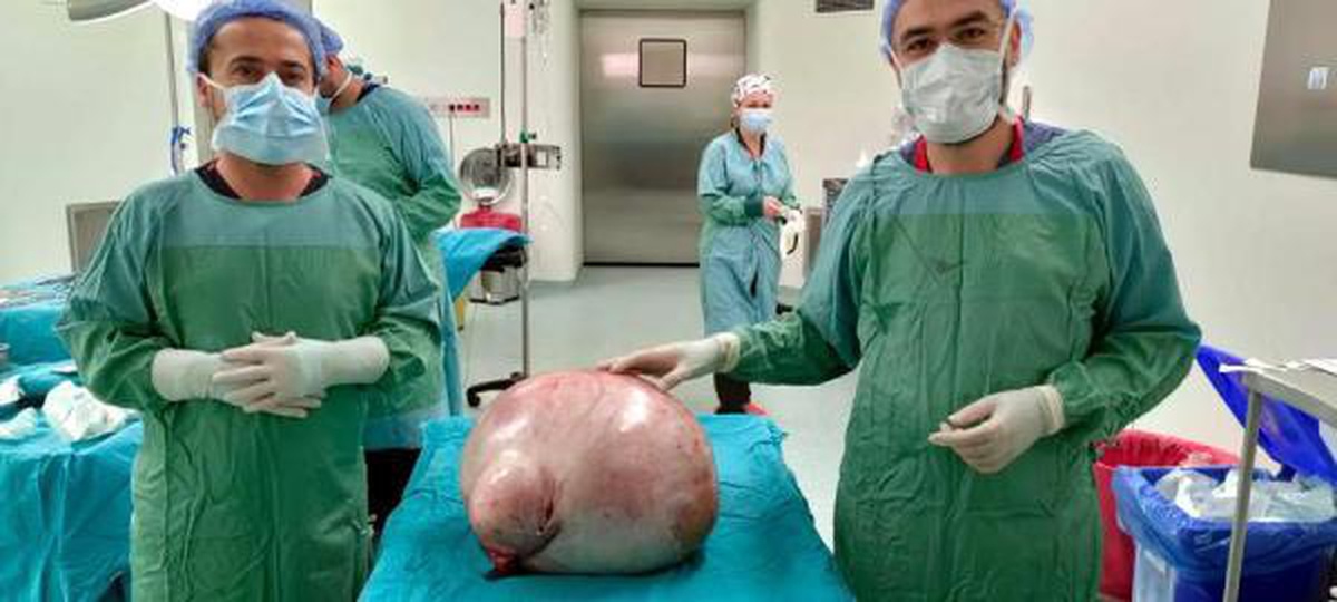 Hastanın karnından 35 kiloluk kitle çıkarıldı
