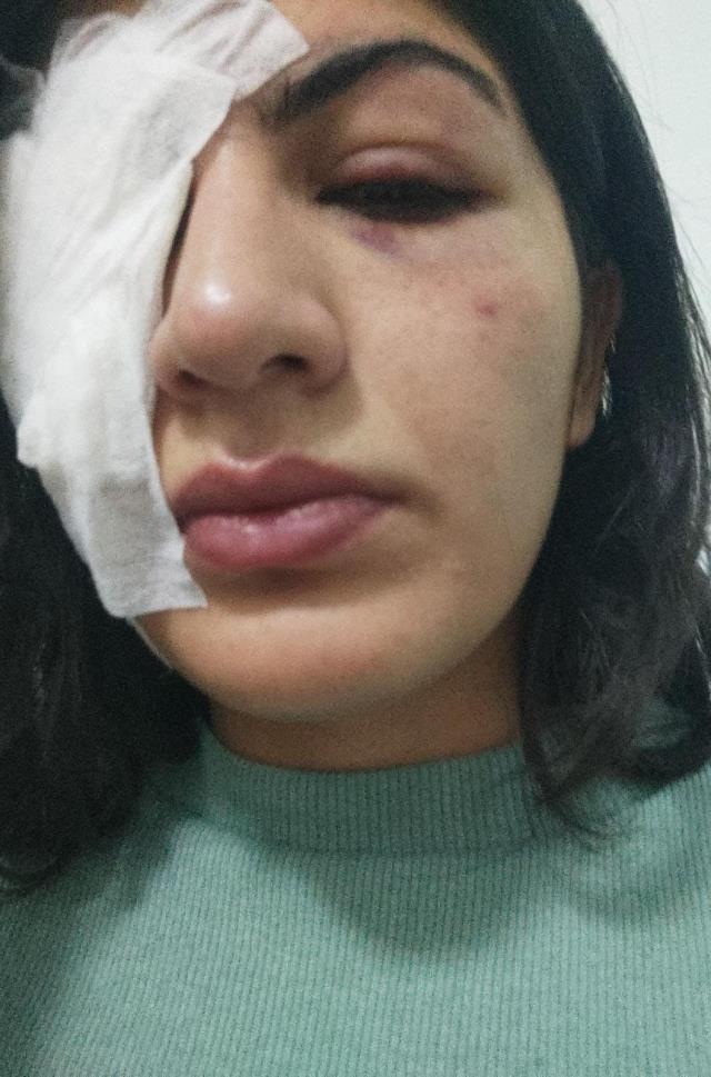 Mersin'de kaldırımda yürüyen genç kıza cisim atan saldırganlardan 'Pes' dedirten savunma: Oyunlardan etkilenmişler