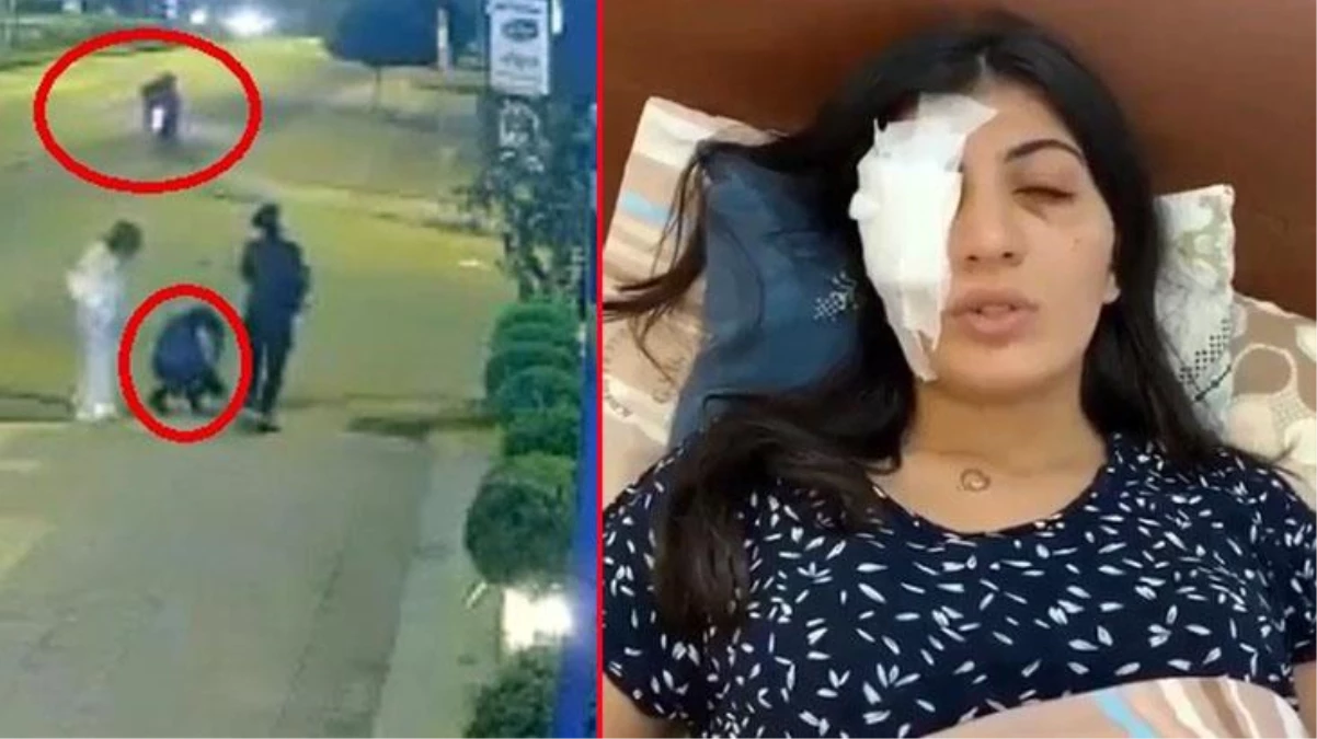 Kaldırımda yürüyen genç kızı fırlattıkları cisimle yaralayan motosikletli saldırganların savunması "yok artık" dedirtti: Oyun videosundakini uyguladık
