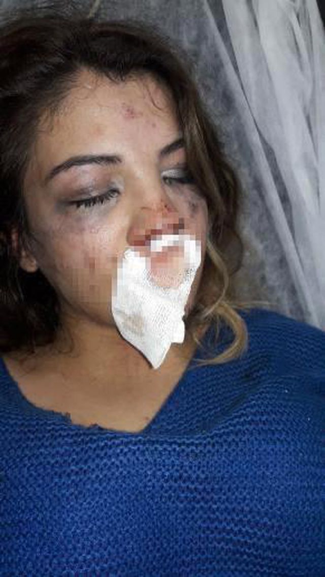 Üsküdar'da koca dehşeti: 4 aylık hamile karısını çocuğunun gözü önünde dövdü Üsküdar'da koca dehşeti: 4 aylık hamile karısını çocuğunun gözü önünde dövdü