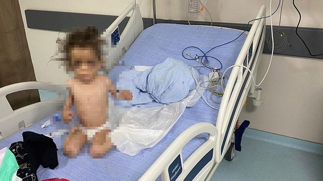 Gaziantep'te anne işkencesi! Günler sonra eve giden baba, küçük kızı bir deri bir kemik buldu