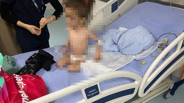 Gaziantep'te anne işkencesi! Günler sonra eve giden baba, küçük kızı bir deri bir kemik buldu