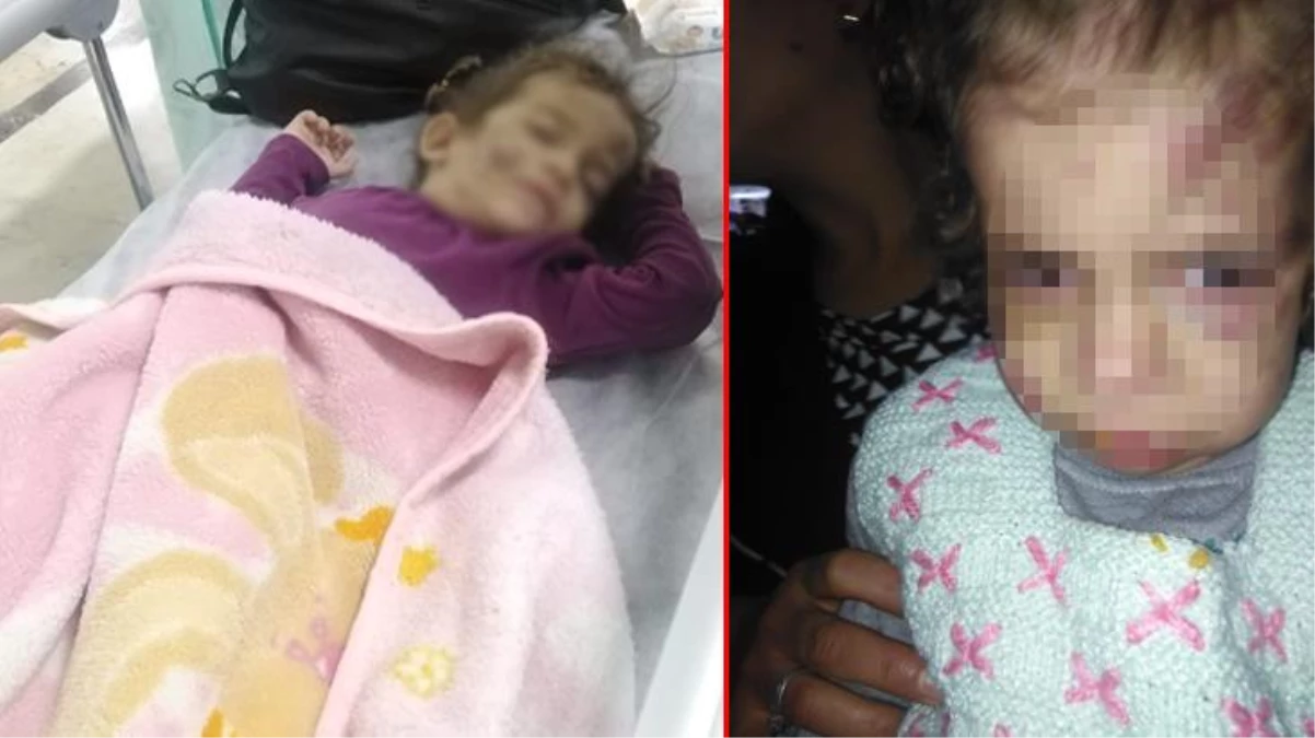 Gaziantep\'te 5 yaşındaki kızı Firdevs\'i aç bırakıp döven anne tutuklandı, 3 kardeş koruma altına alındı