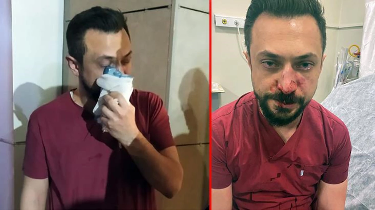 Şanlıurfa\'da hasta yakını saldırdığı doktorun burnunu kırdı