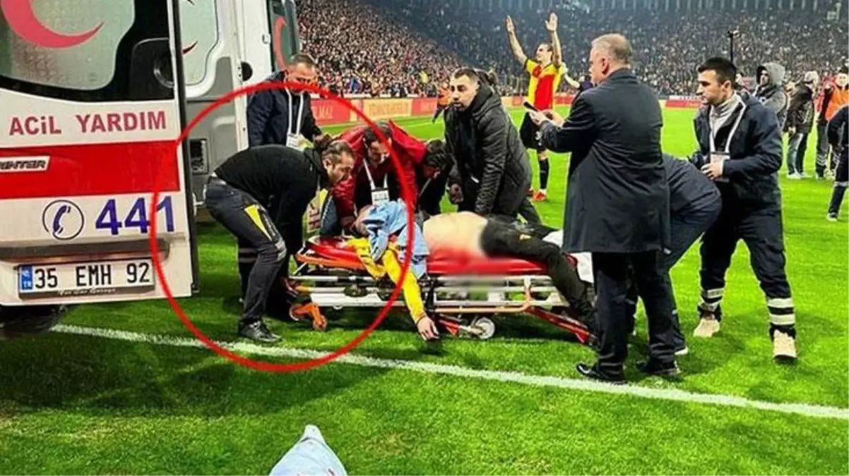 Olaylı Göztepe-Altay maçında suratına havai fişek isabet eden ve soluk borusu parçalanan Mehmet Çakır\'ın bir daha konuşamama riski bulunuyor
