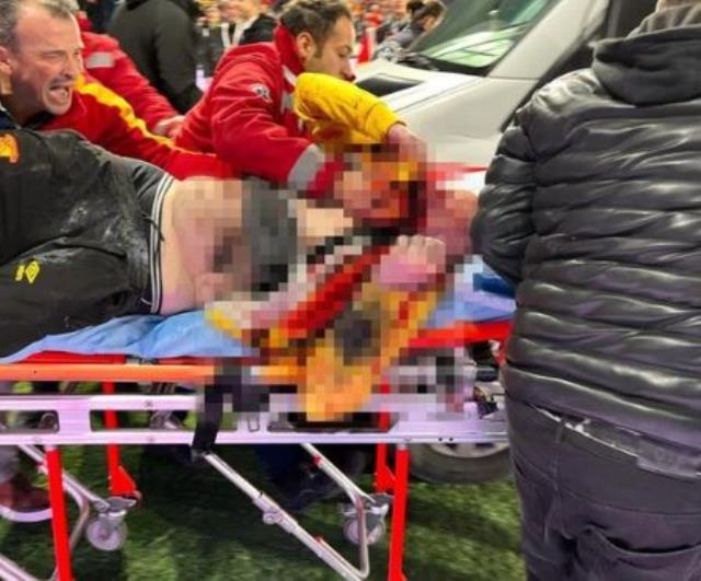 İzmir derbisinde suratına havai fişek isabet eden taraftarla ilgili kahreden ihtimal: Bir daha konuşamayabilir İzmir derbisinde suratına havai fişek isabet eden taraftarla ilgili kahreden ihtimal: Bir daha konuşamayabilir